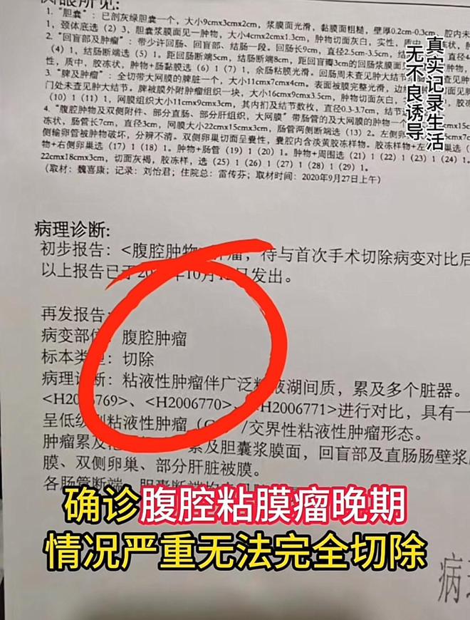 泛亚·电竞(中国)官方网站正月没过完就有4位网红去世有人接连倒霉出事有人一语成谶(图4)